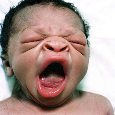 Ugly Baby Pictures on Man Sues Wife   Wins  120k For Giving Birth To    Ugly    Baby